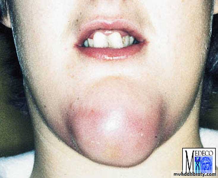 Infectious Disease