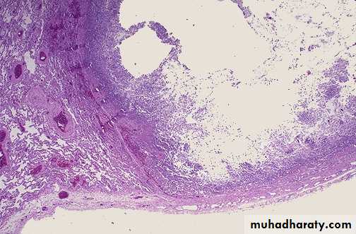 Infectious Disease