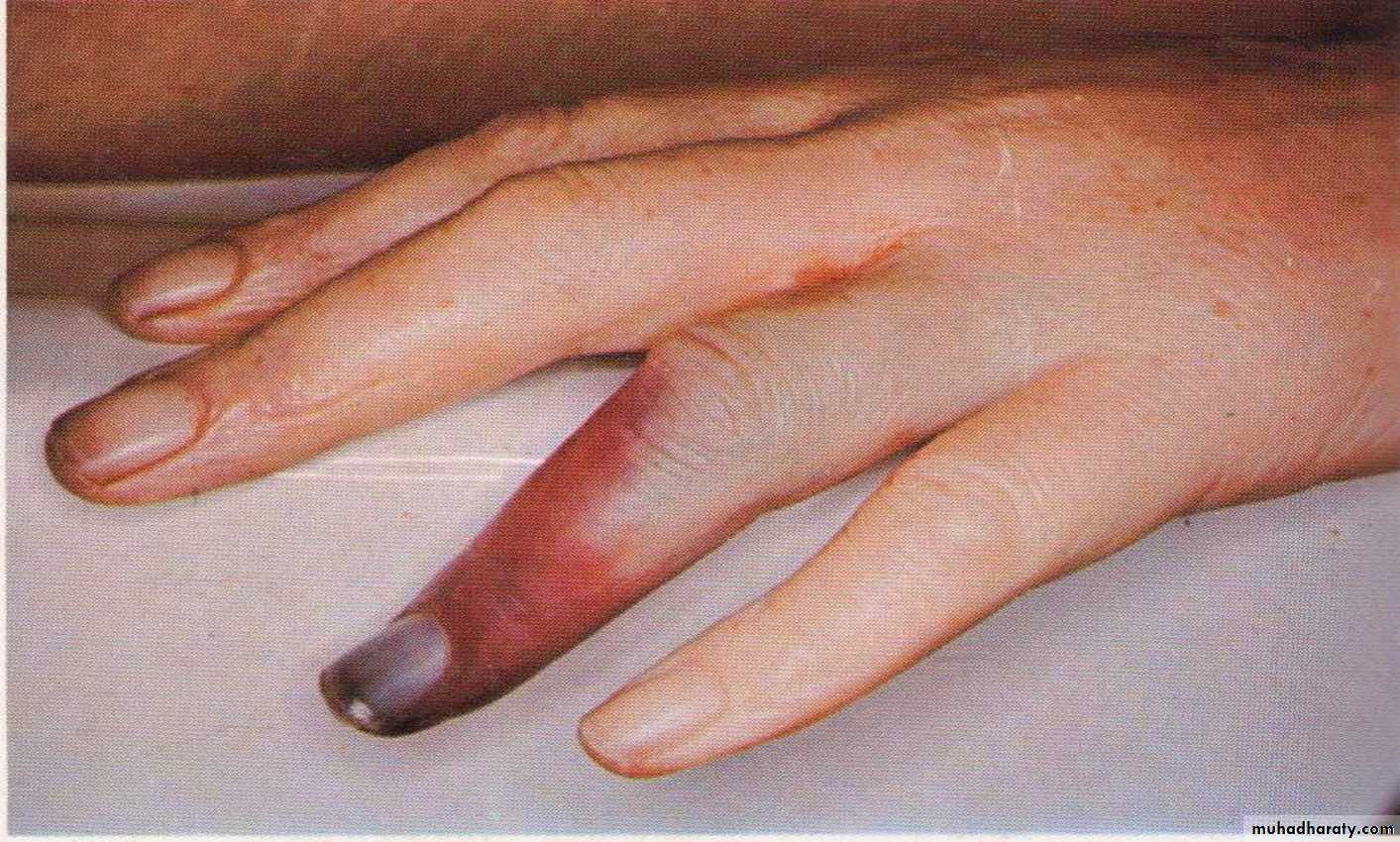 Infectious Disease