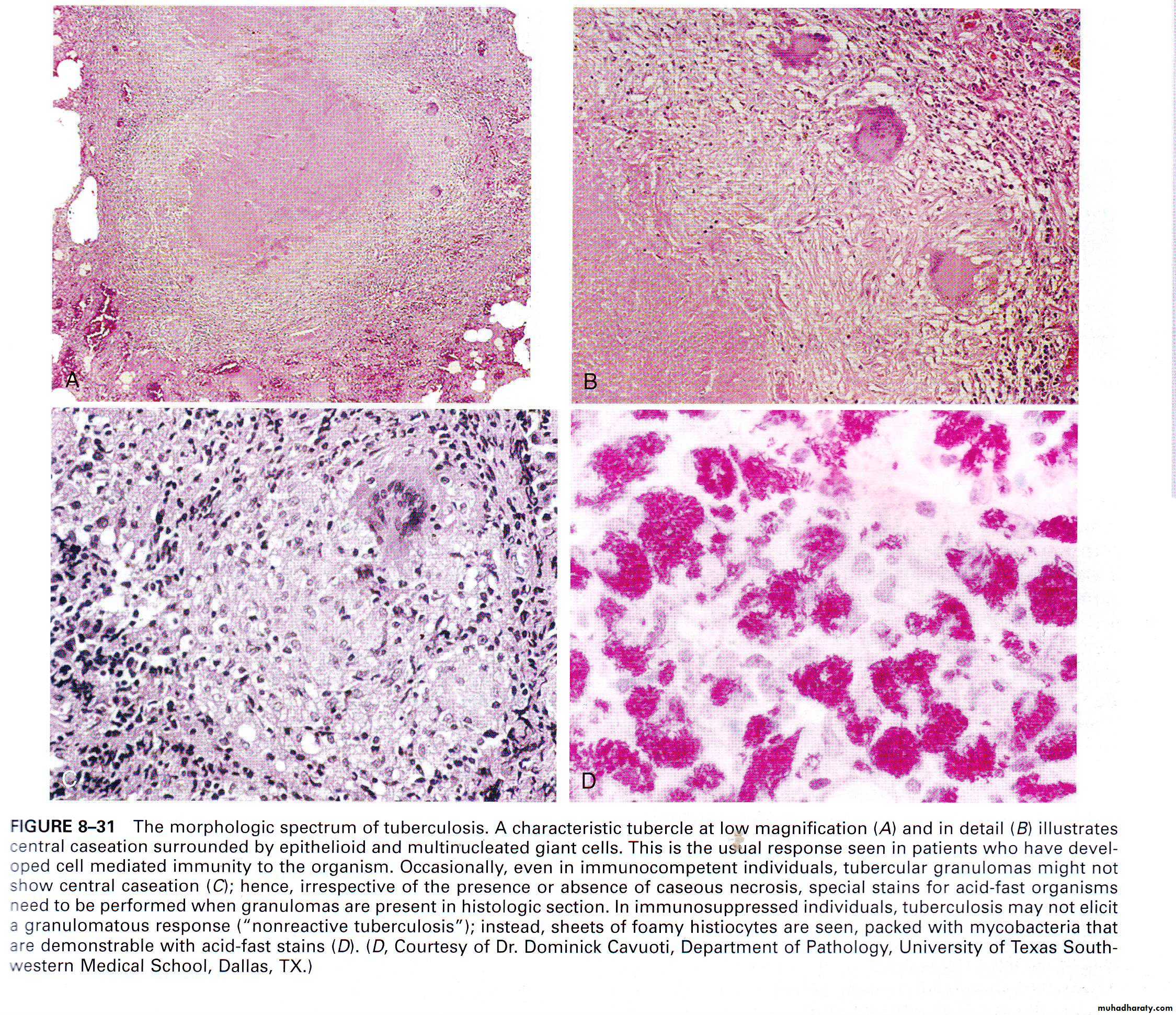 Infectious Disease