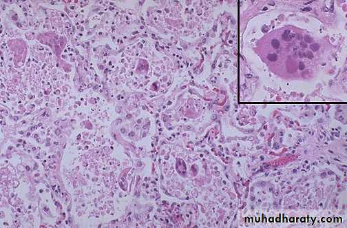 Practical infectious disease