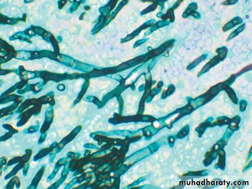 Practical infectious disease
