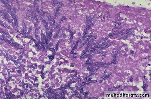 Practical infectious disease