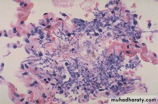 Practical infectious disease
