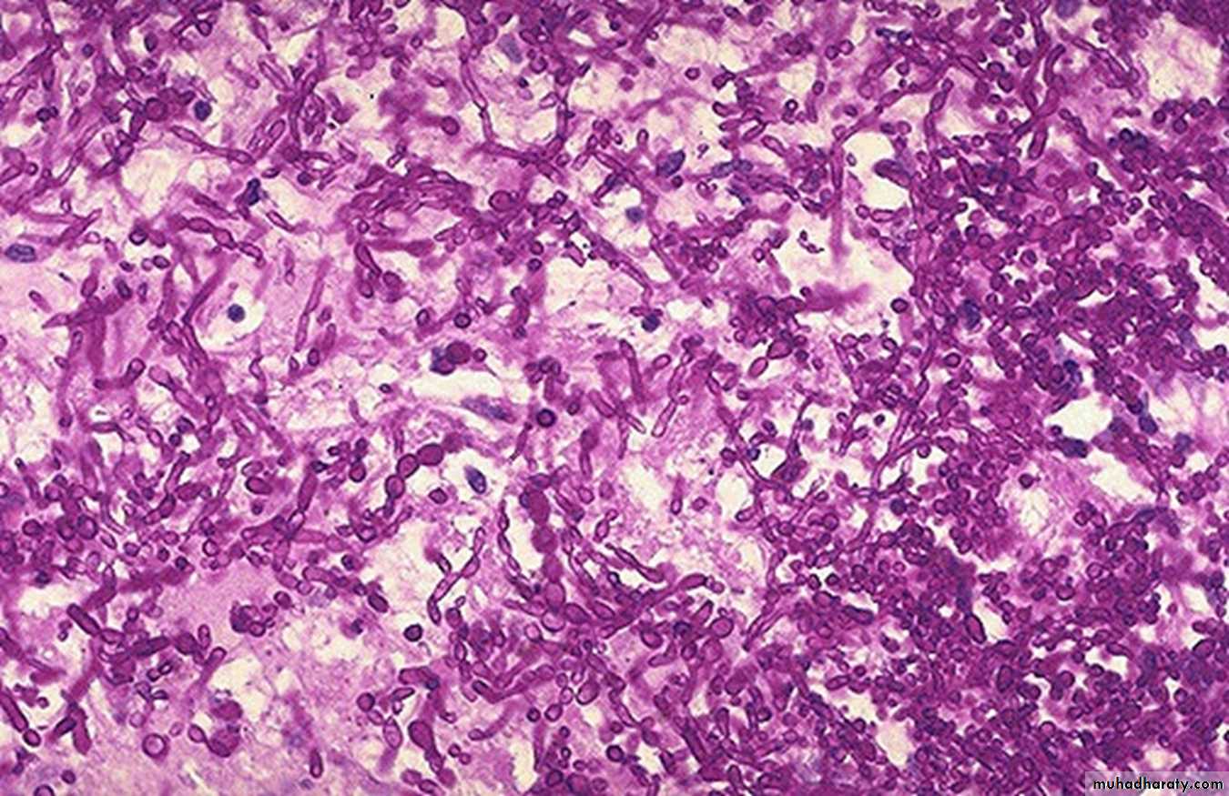 Practical infectious disease