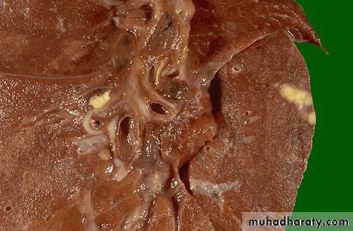 Practical infectious disease