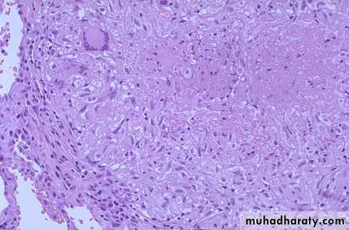 Practical infectious disease