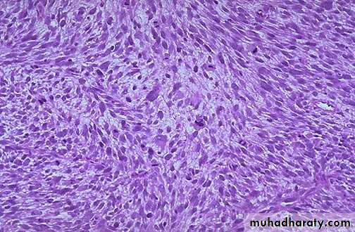 Neoplasia