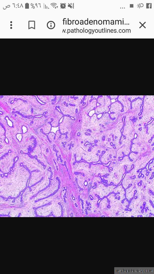 Neoplasia
