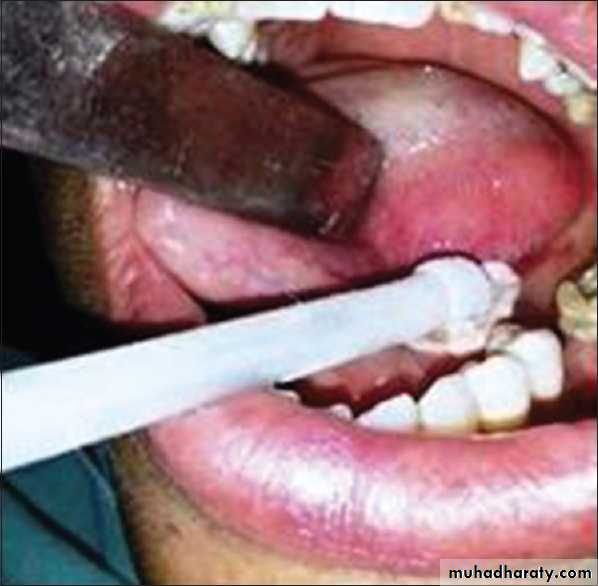 Cryosurgery