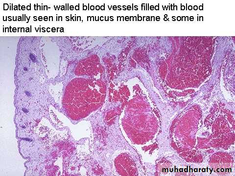 Neoplasia