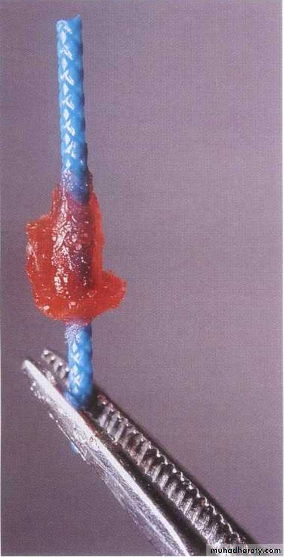 Post and core
