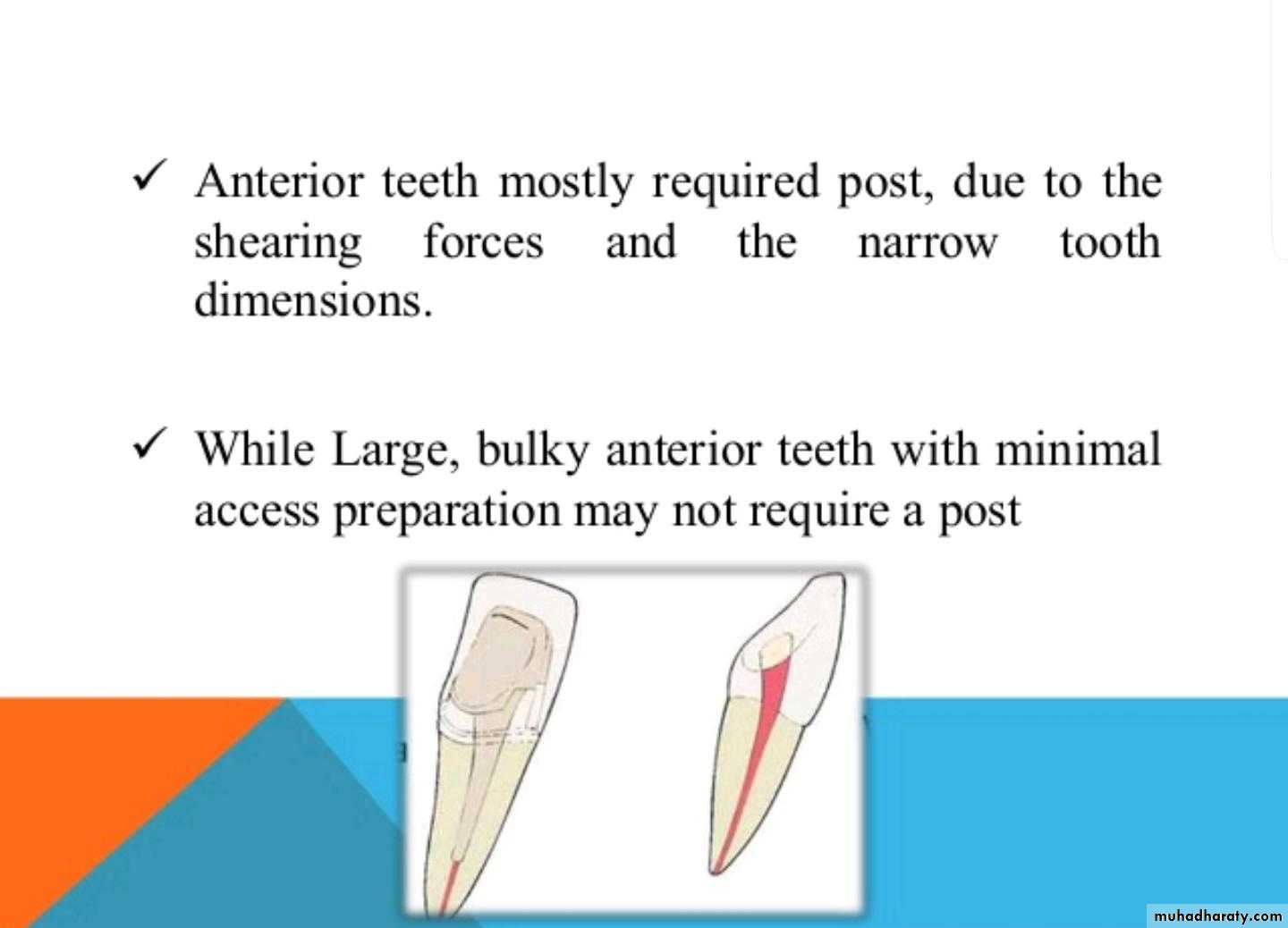 Post and core