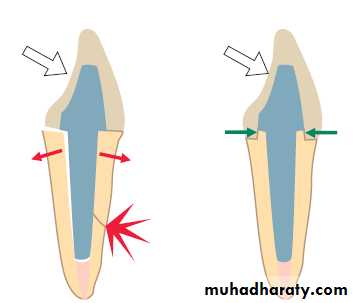 Post and core