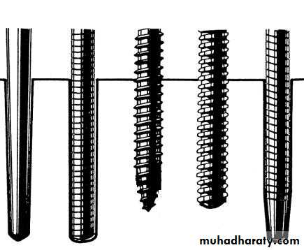 Post and core