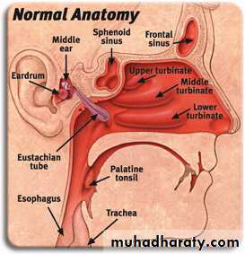 Sinusitis