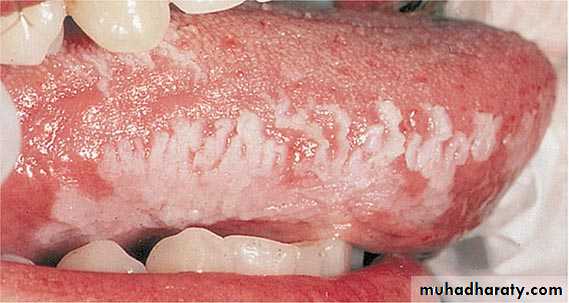 Immunodefeciency