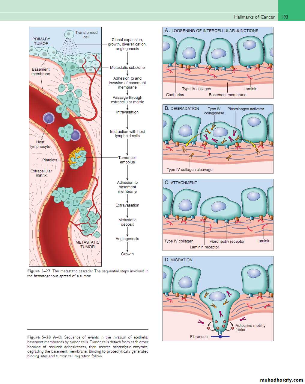 Neoplasia
