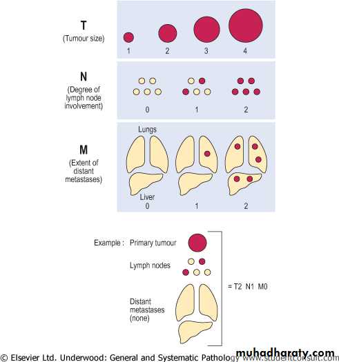 Neoplasia