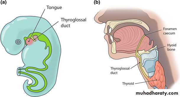 cyst