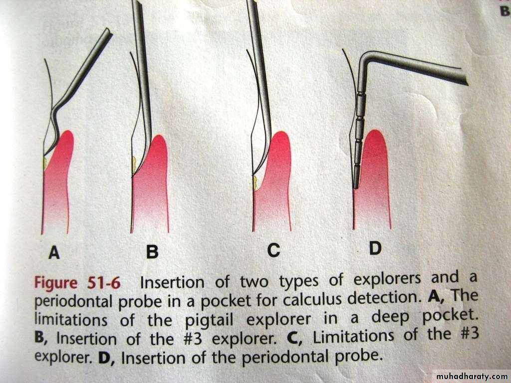 periodontal instruments
