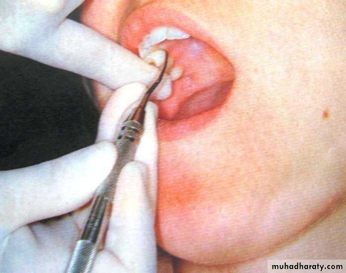 periodontal instruments