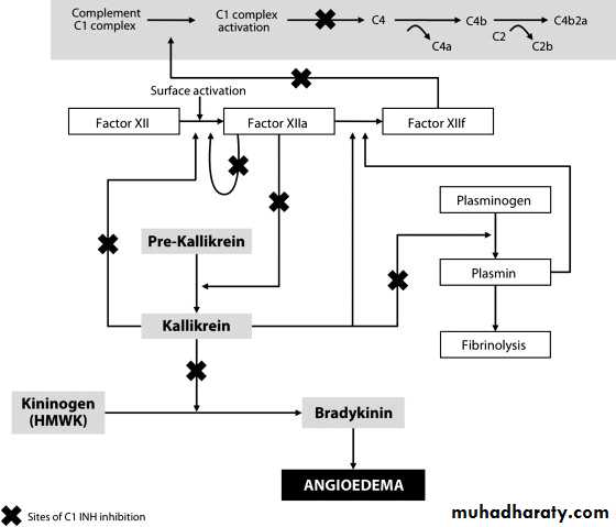 Urticaria