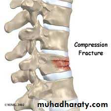Spine Fractures