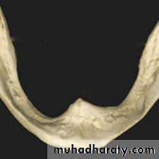 Pre-prosthetic Surgery