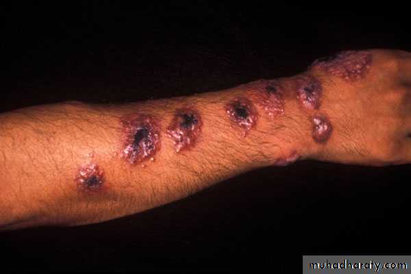 Parasitology