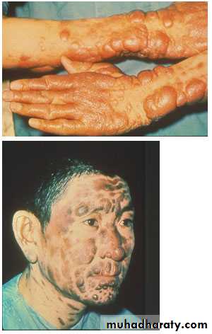 Parasitology
