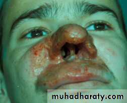 Parasitology