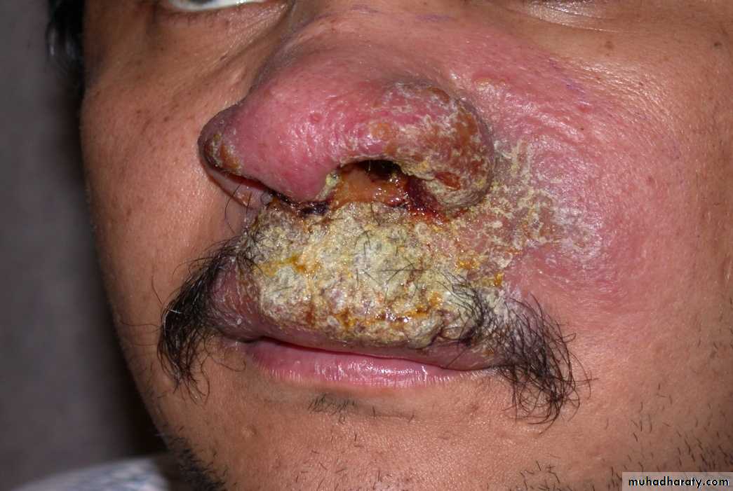 Parasitology