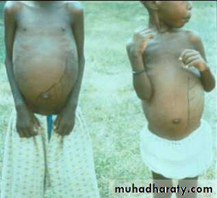 Parasitology