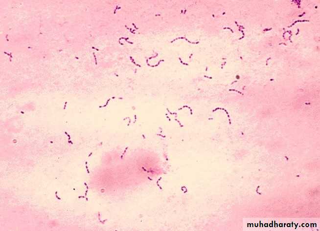 Streptococcus