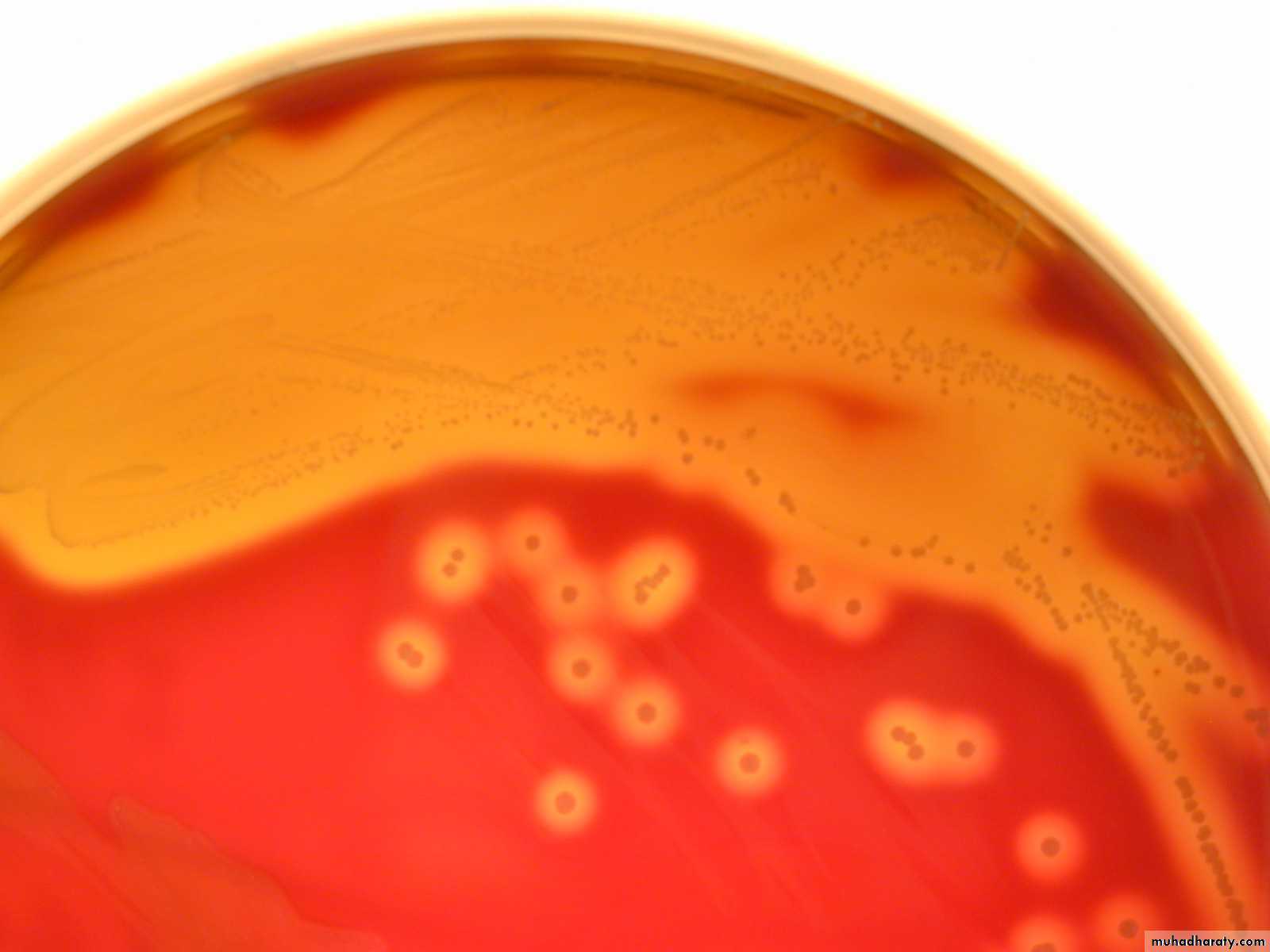 Streptococcus