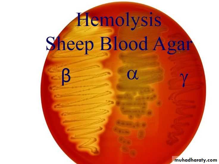 Streptococcus