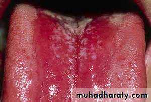 Drug excretion