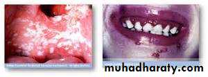 Drug excretion