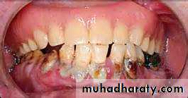 Drug excretion