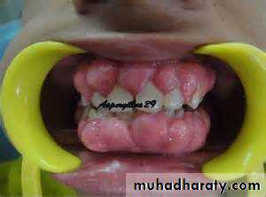 Drug excretion