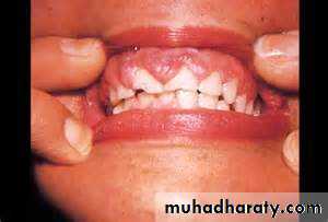 Drug excretion