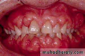 Drug excretion