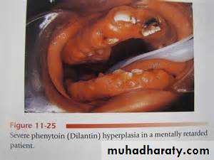 Drug excretion