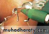 Laboratory procedures