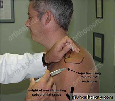Rotator Cuff Disorders