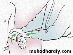 Rotator Cuff Disorders