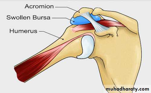 Rotator Cuff Disorders