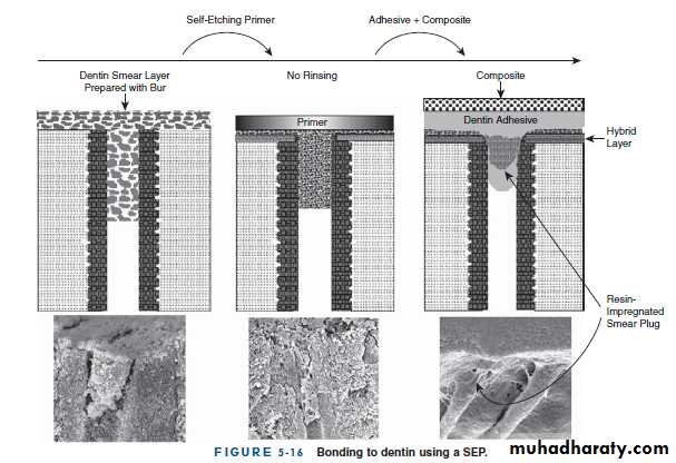 Dental Adhesion