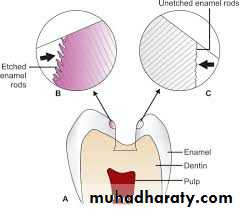 Dental Adhesion